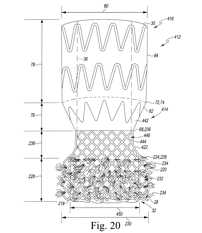 Aortic Innovations v. Edwards Lifesciences: When “Outer Frame” Becomes “Self-Expanding” by Implication